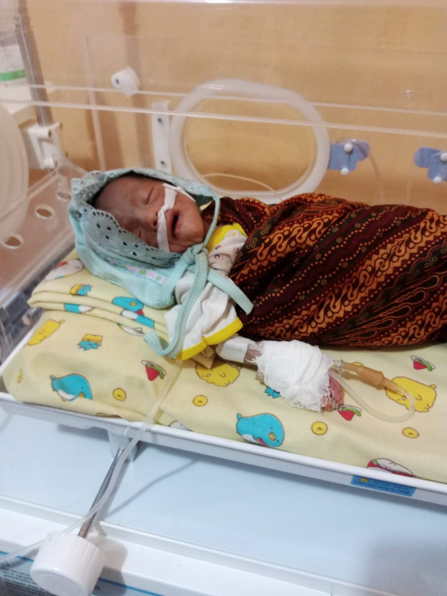 Kasihan, Bayi Berusia 2 Bulan di Padangsidimpuan Diduga Alami Gizi Buruk